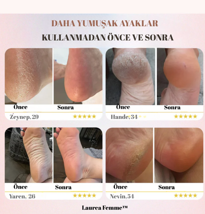 SoftFeet Elektrikli Ayak Törpüsü