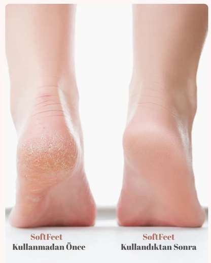 SoftFeet Elektrikli Ayak Törpüsü